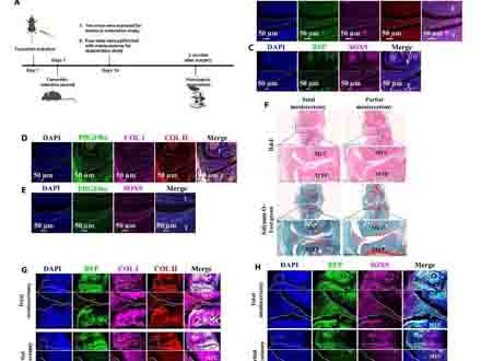 3D打印仿真半月板支架结合自体滑膜移植有望克服半月板再生问题